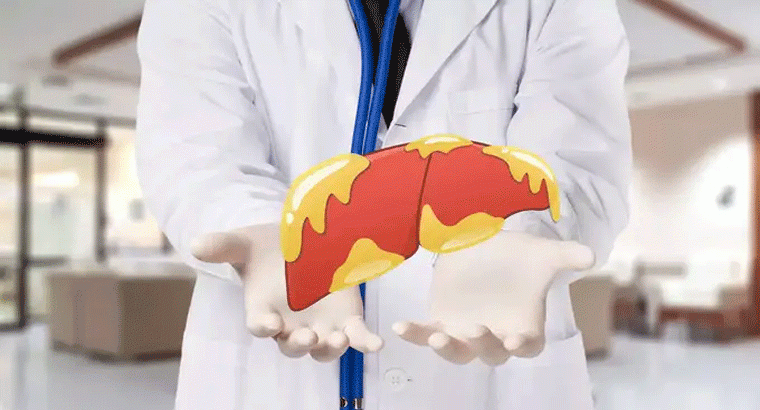 కాలేయానికి కొవ్వు పడితే శరీరంలో కొన్ని లక్షణాలు కనిపిస్తాయి