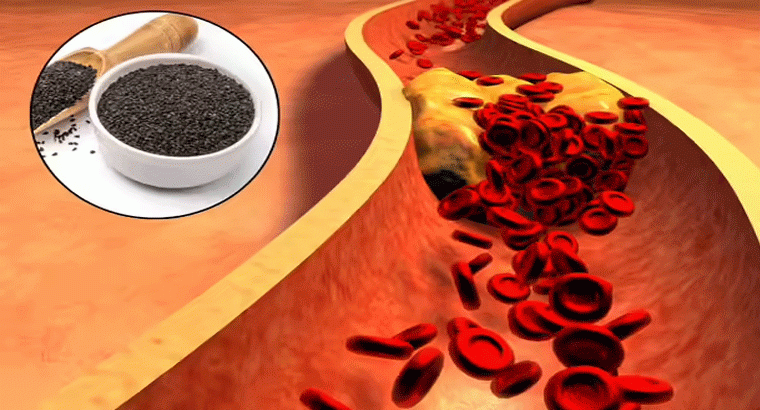 బ్లడ్‌ప్రెజర్, కొలెస్ట్రాల్, అధికబరువు తగ్గేందుకు కలోంజిగింజల్ని ఎలా తీసుకోవాలి