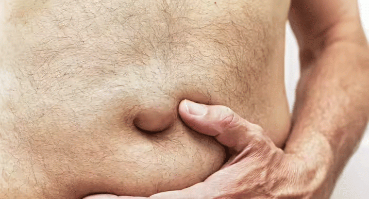 మీ నాభి జారినప్పుడు కనిపించే లక్షణాలు ఇవే