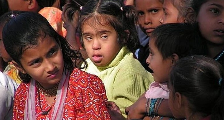 డౌన్స్‌ సిండ్రోమ్‌.. ఆరోగ్యకరమైన జీవితం కోసం క్రమం తప్పని వైద్య పరీక్షలు అవసరం!

