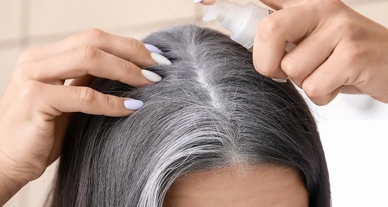 తెల్లజుట్టు సమస్యకు వంటింటి చిట్కా: సొరకాయ నూనెతో సహజమైన పరిష్కారం!

