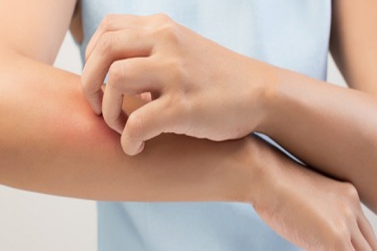 స్కిన్ అలర్జీతో బాధపడుతున్నారా....?

