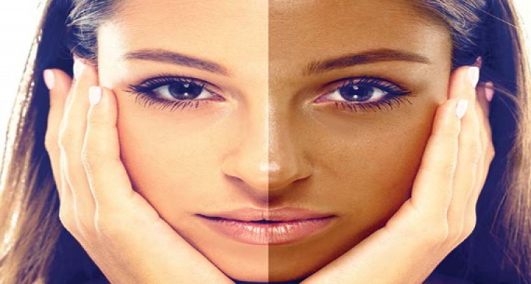 వేసవిలో వేధించే ట్యాన్ కు చెక్ పెట్టండిలా... 

