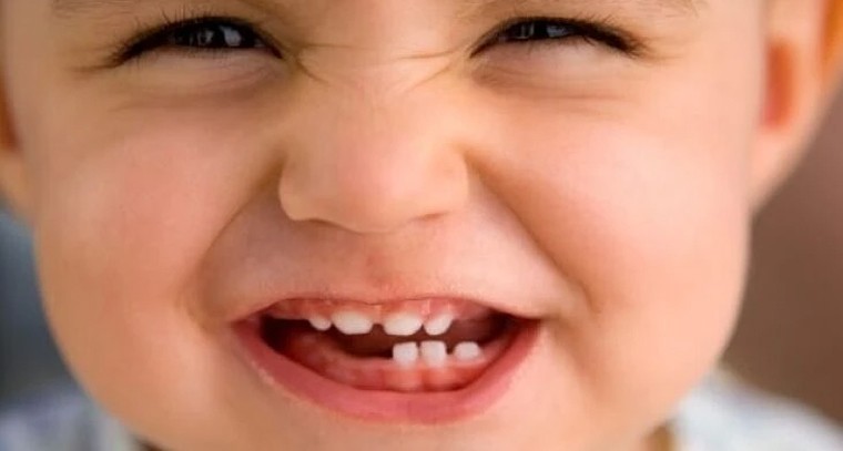 చిన్నారుల్లో పళ్లు వస్తున్నాయా? తల్లిదండ్రులు తీసుకోవాల్సిన జాగ్రత్తలు ఇవే!

