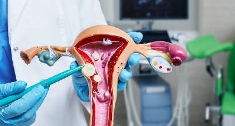 మహిళల స్థాయిలో ఫైబ్రాయిడ్‌ల సమస్య.. దాగి ఉన్న కారణాలు ఏమిటి?

