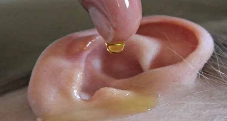 ఆయుర్వేద 'కర్ణాభ్యంగం'.. దీపావళి సంప్రదాయంలో దాగి ఉన్న ఆరోగ్య రహస్యం!

