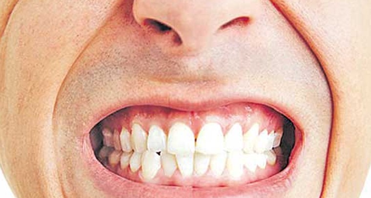 నిద్రలో పళ్లు కొరికే అలవాటు.. ఒత్తిడి నుంచి పోషక లోపాల వరకు దాగి ఉన్న కారణాలు!

