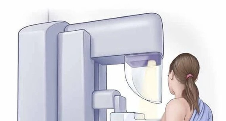 మహిళల ఆరోగ్యం.. రొమ్ము క్యాన్సర్ ముప్పును తప్పించే 'మామోగ్రఫీ'.. ఎప్పుడు చేయించుకోవాలి?

