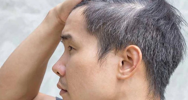 జుట్టు తెల్లబడటం క్యాన్సర్‌ను తగ్గిస్తుందా? జపాన్ శాస్త్రవేత్తల సంచలన ఆవిష్కరణ

