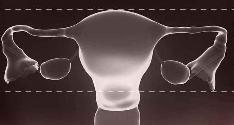 గర్భాశయ పరిమాణం.. సంతానోత్పత్తిపై దాని ప్రభావం మరియు వాస్తవాలు

