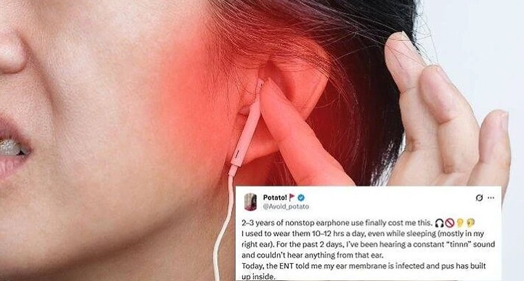 ఇయర్‌ఫోన్ బానిసలారా.. చెవులు చీముతో నిండిపోతాయ్!

