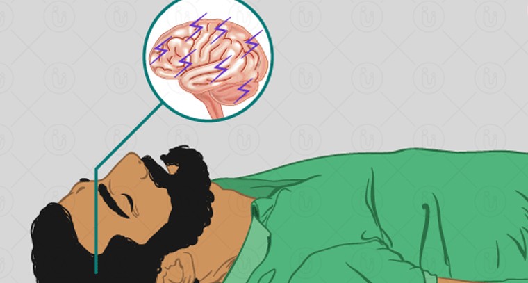 మూర్ఛ వెనుక దాగి ఉన్న జన్యు రహస్యాలు.. 19 కొత్త జన్యువులు గుర్తు!

