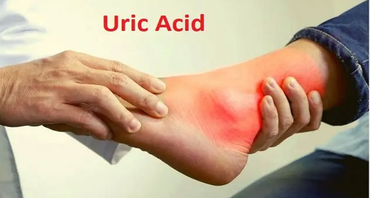 యూరిక్ యాసిడ్‌ని కంట్రోల్ చేసే జీలకర్ర..ఎలా అంటే? 