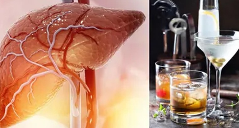 మద్యం తాగే యువతలో పెరుగుతున్న లివర్ సంబంధిత వ్యాధులు: వైద్యులు

