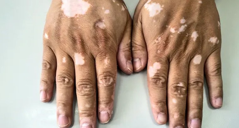 రేపటి నుంచి బ్రహ్మోత్సవాలు