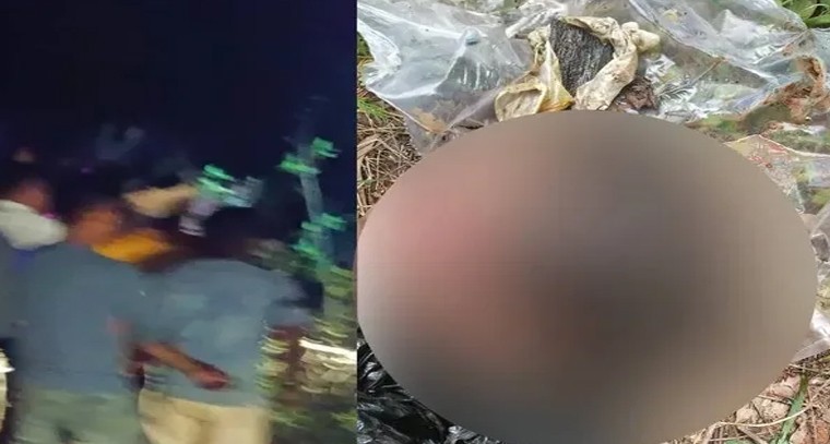 రిషభ్ పంత్ గాయం.. టీమిండియాకు భారీ ఎదురుదెబ్బ, ఇంగ్లండ్ సిరీస్‌లో అనిశ్చితి

