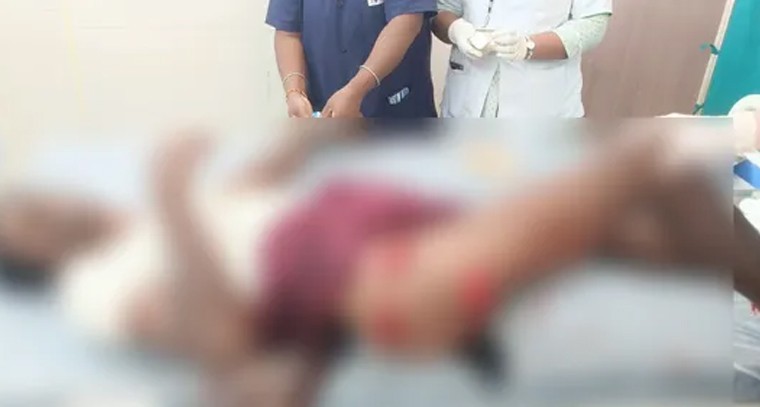 బాదం నూనెతో చుండ్రు సమస్యకు చెక్