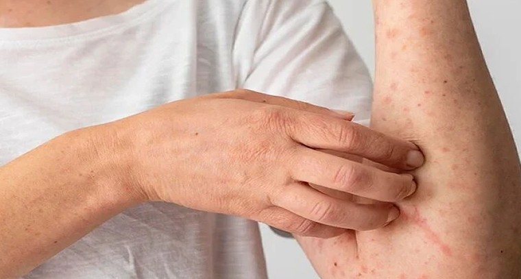 ఆలస్యం చేయకండి! ఈ లక్షణాలు క్యాన్సర్ ముందస్తు సంకేతాలు కావచ్చు

