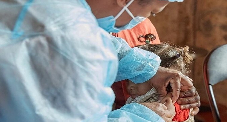 తట్టు మరణాలు 88 శాతం తగ్గాయ్‌.. 5.9 కోట్ల మంది పిల్లల ప్రాణాలు కాపాడిన వ్యాక్సిన్‌ విజయం!

