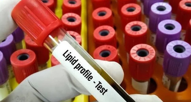 సైలెంట్ కిల్లర్స్‌కు చెక్.. ఆరోగ్యంగా ఉండాలంటే చేయించుకోవాల్సిన 5 కీలక పరీక్షలు

