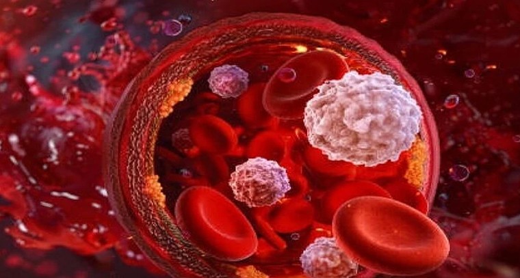 రక్తహీనత దరిచేరకూడదా? మీ ఆహారంలో ఈ మార్పులు తప్పనిసరి

