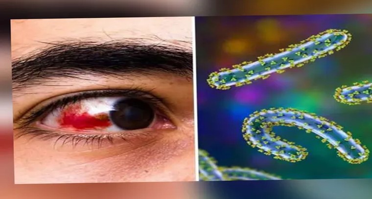 అంతుచిక్కని వ్యాధి.. 150 మంది మృతి

