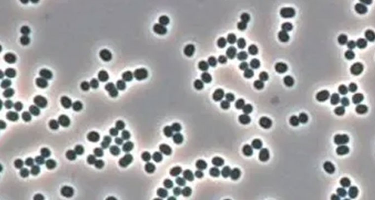 చనిపోయినట్లు నటించే అరుదైన బ్యాక్టీరియా!