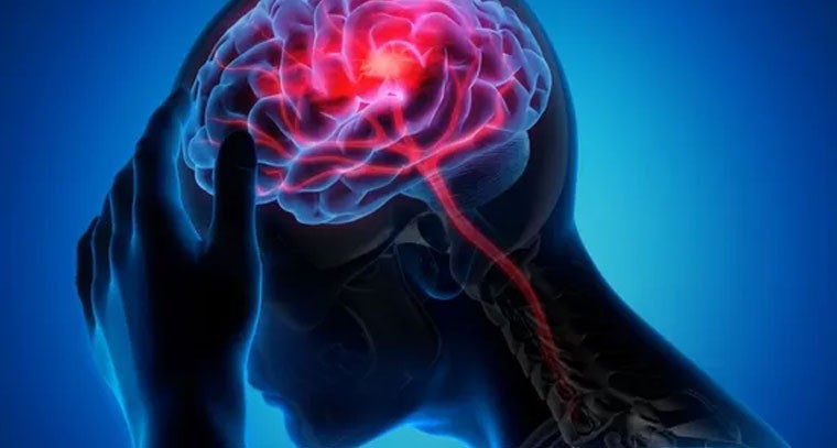 యువతలో పెరుగుతున్న బ్రెయిన్ స్ట్రోక్: ఒత్తిడే ప్రధాన కారణం