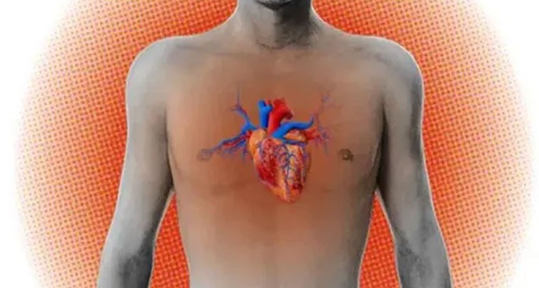 శరీర ఉష్ణోగ్రత పెరిగితే గుండెకు హాని