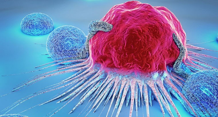 క్యాన్సర్ ప్రారంభ లక్షణాలు ఇవే...