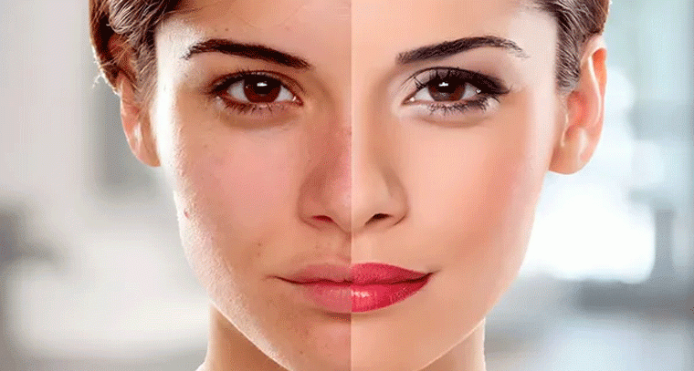 చర్మ సౌందర్యం కోసం రాత్రిపూట ఈ చిట్కాలు పాటించండి