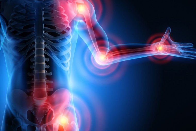 ఆర్థరైటిస్‌పై అవగాహన పెరగడం వల్ల సమస్యలను అధిగమించవచ్చని వైద్యులు చెబుతున్నారు