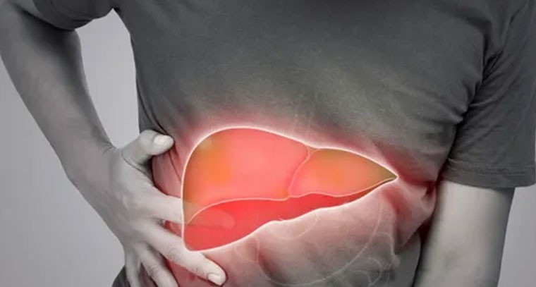 ఫ్యాటీ లివర్ సమస్య.. మిల్క్ టీ తాగొచ్చా?