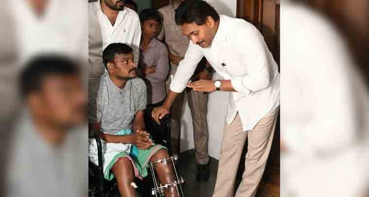 టీడీపీ నేతల దాడిలో గాయపడ్డ కార్యకర్తని పరామర్శించిన జగన్ 