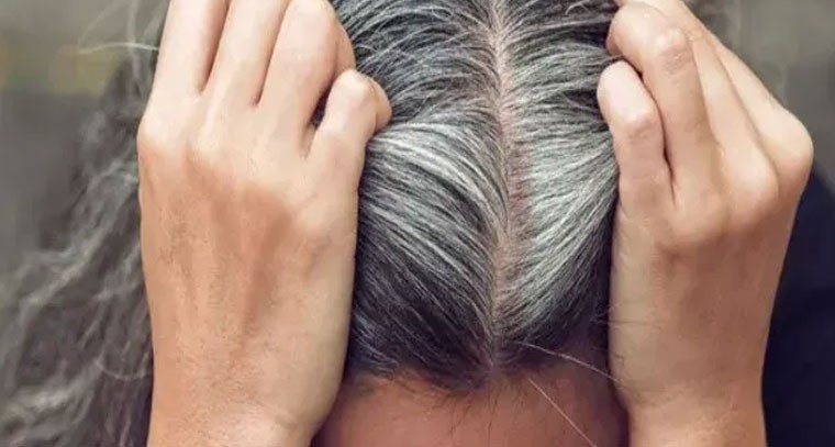 తెల్లజుట్టుకు సహజసిద్ధ పరిష్కారం!