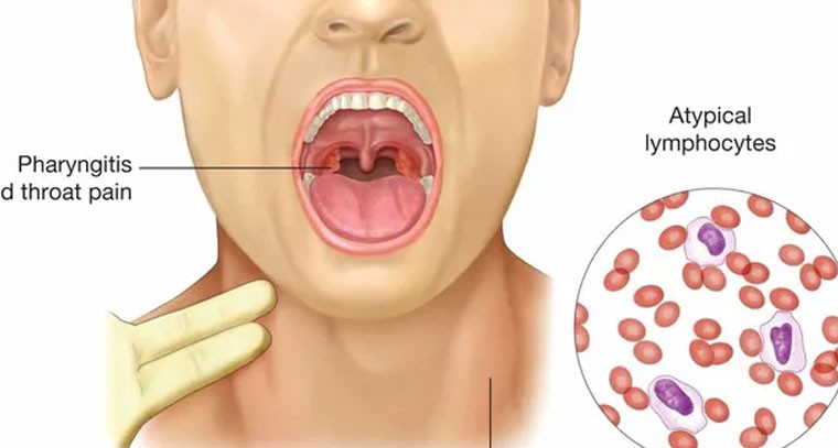 నిర్లక్ష్యం చేస్తే ప్రమాదమే..