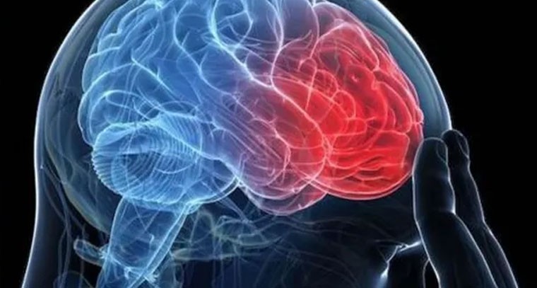 మైగ్రేన్‌‌కు ఈ ఫుడ్స్‌తో చెక్!