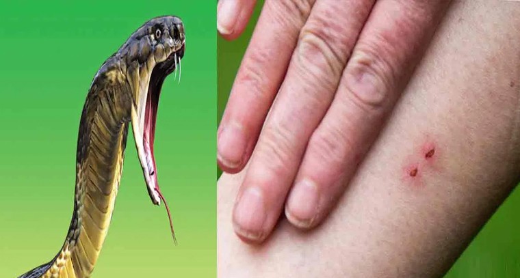 పాము కాటు వేసిన వెంటనే ఇది తింటే విషం వ్యాపించదు!