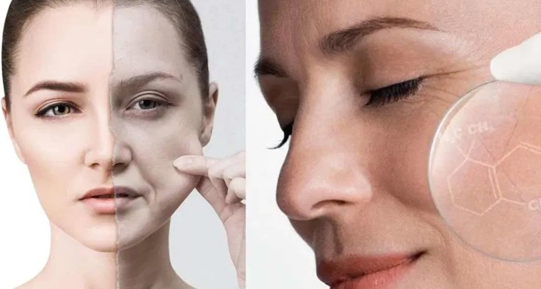  వింటర్ సీజన్‌లో  కొన్ని సహజ చిట్కాలు పొడి చర్మానికి చెక్ 