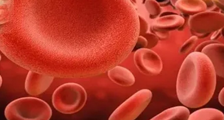 శరీరంలో ఈ ఆరు లక్షణాలు కనిపిస్తే రక్తహీనతకు గురైనట్లే!