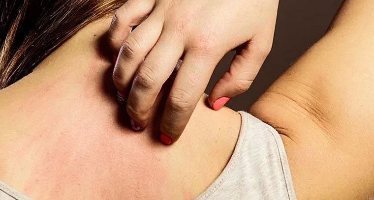 చాలా మందికి చర్మంపై  గోకడం ద్వారా... 