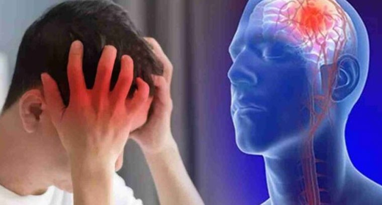 స్ట్రోక్ రావడానికి కొన్ని వారాల ముందు శరీరంలోని కొన్ని లక్షణాలు 