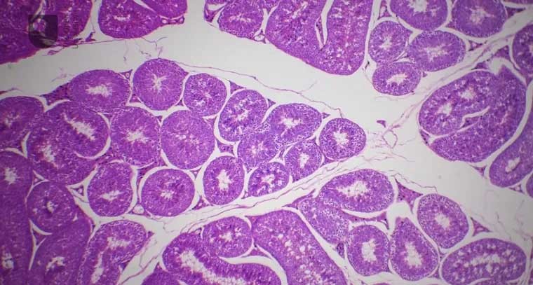 టెస్టోస్టెరాన్ స్థాయిలను పెంచుకోండిలా