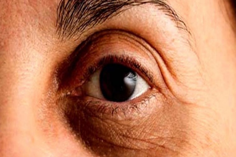 కళ్ల కింద నల్లటి మచ్చలుకి చెక్ పెట్టండి

