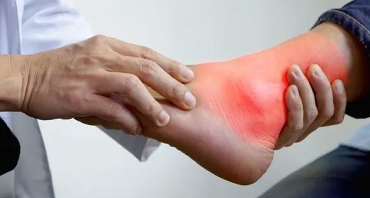 యూరిక్ యాసిడ్ ను తగ్గించే ఆహారాలు ఇవే!