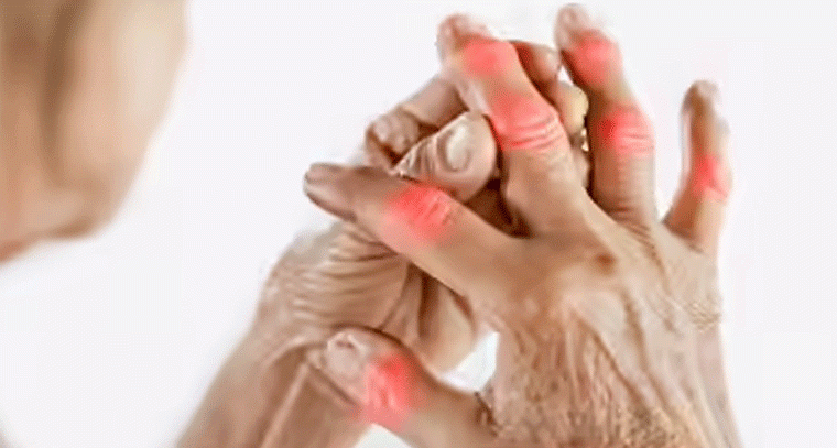 యూరిక్ యాసిడ్ తగ్గాలంటే ఏం తినాలి