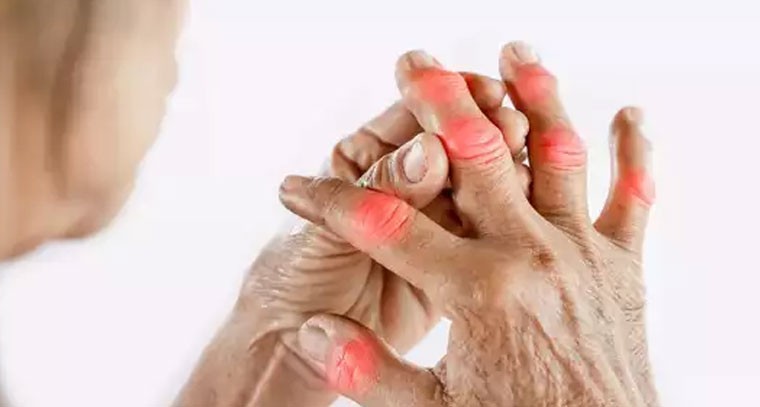 యూరిక్ యాసిడ్ పెరిగితే కీళ్ల నొప్పులు, వాపులు