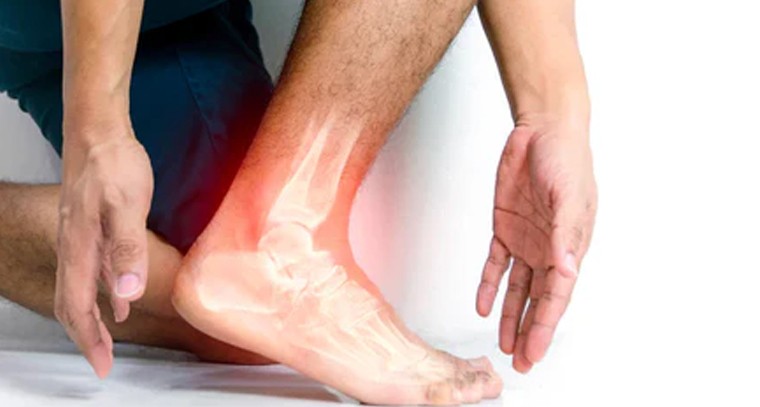 యూరిక్ యాసిడ్‌ పెరగకుండా ఉండాలంటే ఇలా చేయండి