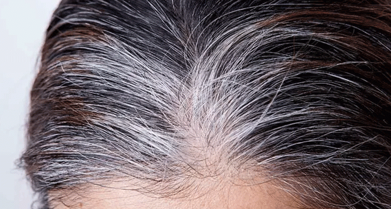 తెల్ల జుట్టు పీకితే మరిన్ని వస్తాయా? నిపుణులు ఏం చెప్తున్నారు..?