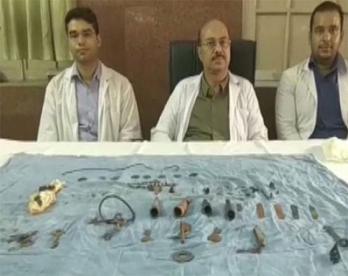 మనిషి కడుపులో ఇనుప వస్తువులు